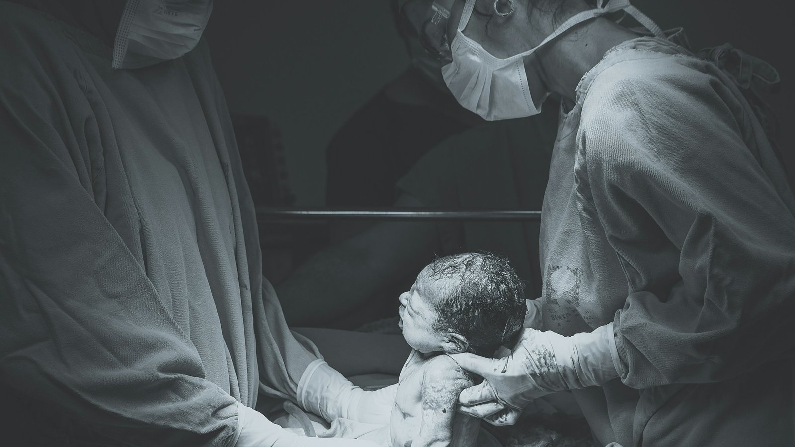 Nacimiento por cesárea, recién nacido acompañado por el equipo médico, imagen en blanco y negro